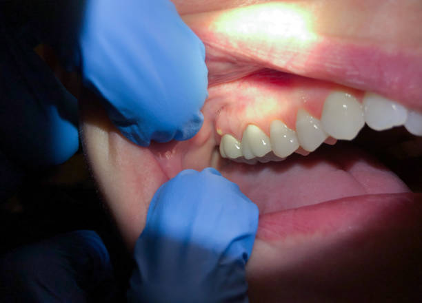 Best Emergency Root Canal Therapy in Buckhead Ridge, FL