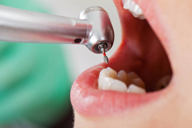  Buckhead Ridge, FL Emergency Dentist Pros